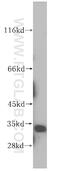 Sirtuin 5 antibody, 15122-1-AP, Proteintech Group, Western Blot image 