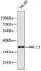 X-Ray Repair Cross Complementing 3 antibody, GTX32975, GeneTex, Western Blot image 