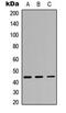 Interleukin 3 Receptor Subunit Alpha antibody, MBS8207935, MyBioSource, Western Blot image 