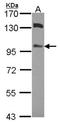 Mitogen-Activated Protein Kinase Kinase Kinase 20 antibody, NBP2-20934, Novus Biologicals, Western Blot image 