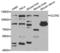 Chloride Voltage-Gated Channel 2 antibody, LS-C334513, Lifespan Biosciences, Western Blot image 