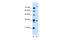 Transmembrane Protein 231 antibody, A10964, Boster Biological Technology, Western Blot image 