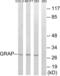 GRB2 Related Adaptor Protein antibody, LS-C199019, Lifespan Biosciences, Western Blot image 