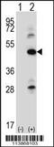 Integrin Linked Kinase antibody, 63-101, ProSci, Western Blot image 