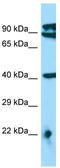 Mitochondrial Transcription Termination Factor 2 antibody, TA334331, Origene, Western Blot image 