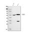 SMAD2 antibody, M00090-3, Boster Biological Technology, Western Blot image 