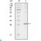 Tyrosine-protein kinase ITK/TSK antibody, LS-C812448, Lifespan Biosciences, Western Blot image 