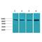 Phosphoinositide-3-Kinase Regulatory Subunit 1 antibody, LS-C387812, Lifespan Biosciences, Western Blot image 