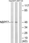 NBPF Member 7 antibody, GTX87785, GeneTex, Western Blot image 