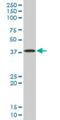 Serine/Threonine/Tyrosine Kinase 1 antibody, H00055359-M02, Novus Biologicals, Western Blot image 