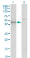 Casein Kinase 1 Gamma 1 antibody, LS-C133765, Lifespan Biosciences, Western Blot image 