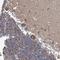 TWIST Neighbor antibody, NBP1-89449, Novus Biologicals, Immunohistochemistry paraffin image 