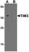 Hepatitis A Virus Cellular Receptor 2 antibody, A00657, Boster Biological Technology, Western Blot image 