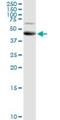 ALG2 Alpha-1,3/1,6-Mannosyltransferase antibody, H00085365-D01P, Novus Biologicals, Western Blot image 