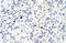 Spliceosome Associated Factor 3, U4/U6 Recycling Protein antibody, 29-012, ProSci, Immunohistochemistry paraffin image 