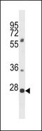 Pleckstrin Homology And FYVE Domain Containing 1 antibody, LS-C163787, Lifespan Biosciences, Western Blot image 