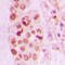 LIM Domain Kinase 2 antibody, LS-C352456, Lifespan Biosciences, Immunohistochemistry paraffin image 