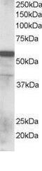 Ring Finger Protein 8 antibody, PA1-31259, Invitrogen Antibodies, Western Blot image 