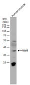 Myogenic Factor 5 antibody, GTX129925, GeneTex, Western Blot image 