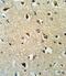 Rho GDP Dissociation Inhibitor Alpha antibody, LS-C156475, Lifespan Biosciences, Immunohistochemistry paraffin image 