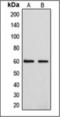 Cytochrome P450 Family 4 Subfamily F Member 2 antibody, orb376086, Biorbyt, Western Blot image 