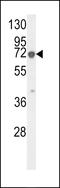 Keratin 9 antibody, 62-813, ProSci, Western Blot image 