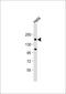 Clathrin Heavy Chain antibody, 62-101, ProSci, Western Blot image 