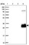 ADAMTS13 antibody, NBP2-14265, Novus Biologicals, Western Blot image 