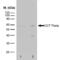 Chaperonin Containing TCP1 Subunit 8 antibody, MCA2180, Bio-Rad (formerly AbD Serotec) , Western Blot image 