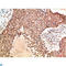 ATM Serine/Threonine Kinase antibody, LS-C813192, Lifespan Biosciences, Immunohistochemistry paraffin image 