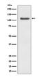 Mitogen-Activated Protein Kinase 7 antibody, M02812, Boster Biological Technology, Western Blot image 