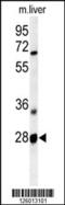 Receptor Transporter Protein 2 antibody, 61-779, ProSci, Western Blot image 