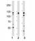 Fibroblast Growth Factor Receptor 2 antibody, F50617-0.4ML, NSJ Bioreagents, Immunohistochemistry frozen image 