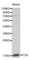 Transthyretin antibody, abx001035, Abbexa, Western Blot image 