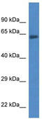 Acyl-CoA Synthetase Family Member 2 antibody, TA343062, Origene, Western Blot image 