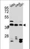 Heterogeneous Nuclear Ribonucleoprotein C (C1/C2) antibody, LS-C164956, Lifespan Biosciences, Western Blot image 