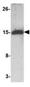 BCL2 Like 11 antibody, GTX84980, GeneTex, Western Blot image 