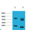 Potassium Voltage-Gated Channel Subfamily A Member 10 antibody, LS-C813648, Lifespan Biosciences, Western Blot image 