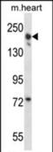 Capping Protein Regulator And Myosin 1 Linker 3 antibody, PA5-71874, Invitrogen Antibodies, Western Blot image 