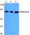 P21 (RAC1) Activated Kinase 4 antibody, A01723-1, Boster Biological Technology, Western Blot image 