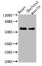 Liver carboxylesterase 1 antibody, A62258-100, Epigentek, Western Blot image 