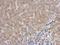 Rac GTPase Activating Protein 1 antibody, GTX113320, GeneTex, Immunohistochemistry paraffin image 