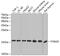 Translocase Of Outer Mitochondrial Membrane 20 antibody, GTX32928, GeneTex, Western Blot image 