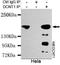 DCTN1 antibody, M02175, Boster Biological Technology, Immunoprecipitation image 