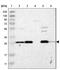 Adenylate Kinase 2 antibody, NBP1-86043, Novus Biologicals, Western Blot image 