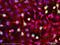 Centromere Protein F antibody, ab5, Abcam, Immunofluorescence image 