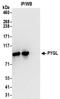 Glycogen Phosphorylase L antibody, NBP2-32246, Novus Biologicals, Immunoprecipitation image 