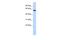 EYA Transcriptional Coactivator And Phosphatase 1 antibody, PA5-40545, Invitrogen Antibodies, Western Blot image 