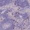 Tryptase Delta 1 antibody, NBP2-46776, Novus Biologicals, Immunohistochemistry frozen image 