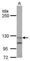 Unc-13 Homolog D antibody, GTX117155, GeneTex, Western Blot image 